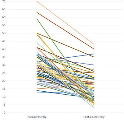 Is Laparoscopic Pyeloplasty for Ureteropelvic Junction Obstruction in Infants Under 1 Year of Age a Good Option?